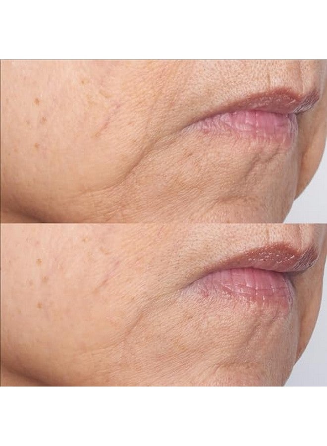 Cold Plasma Plus+ The Intensive Gel Mask Ultrahydrating & Cooling Improves Uneven Texture Wrinkles Loss Of Radiance & Firmness. Leaves Skin Instantly Hydrated Soft & Supple
