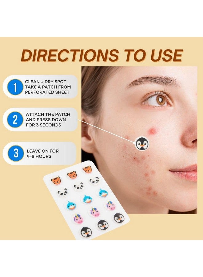 Pretty Animalz Acne Printed Hydrocolloid Patches Extracts Oil And Impurities Conceals Blemishes And Acne