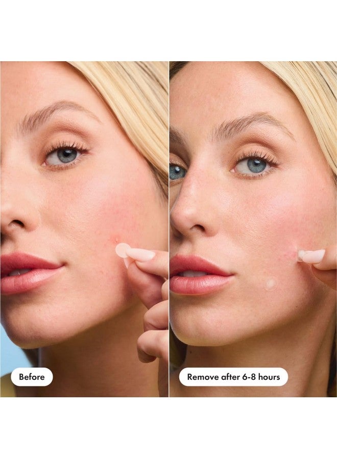 Mighty Patch™ Mini Invisible+ Patches Extra Small Daytime Hydrocolloid Acne Pimple Patches For Covering Zits And Blemishes Blends Into Skin And Barely There (30Ct 10Mm Patches)