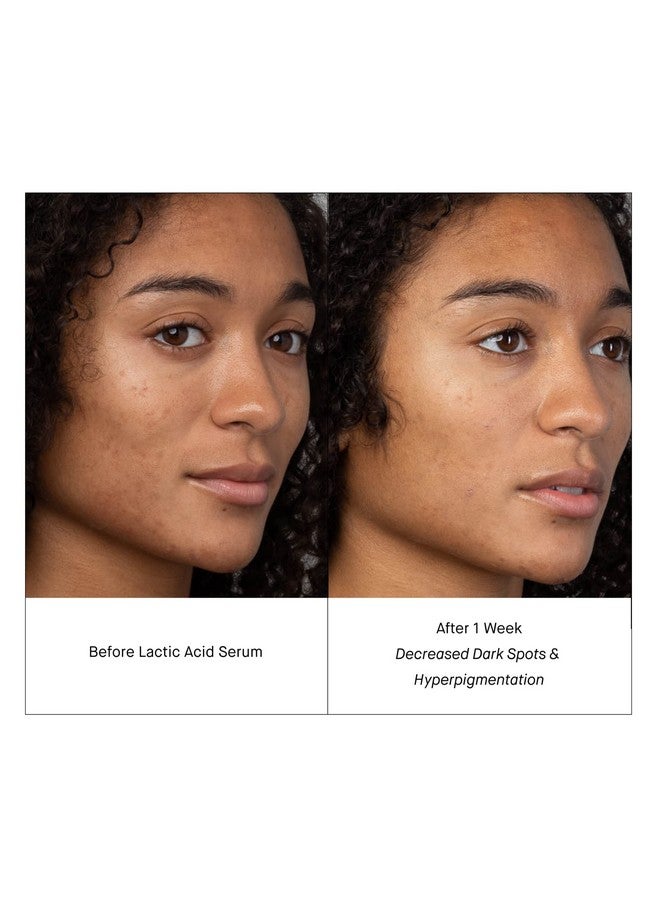 Skincare Lactic Acid Face Serum Active Night Serum To Help With The Look Of Radiant And Smooth Skin Gentle But Powerful Face Exfoliator 1.01 Fl Oz