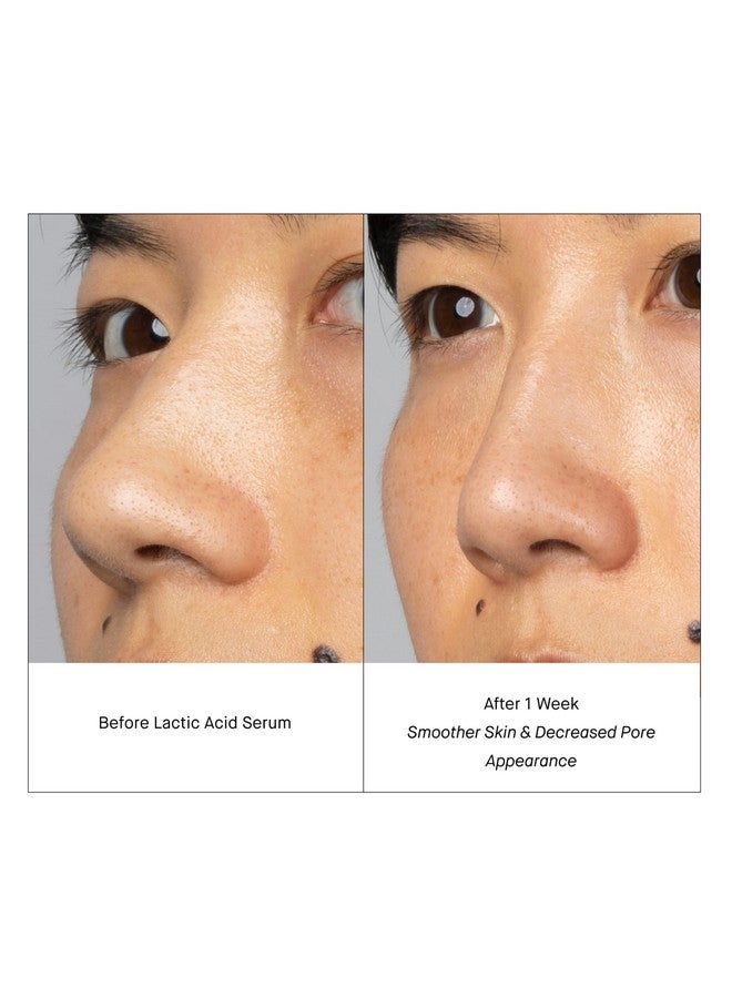 Skincare Lactic Acid Face Serum Active Night Serum To Help With The Look Of Radiant And Smooth Skin Gentle But Powerful Face Exfoliator 1.01 Fl Oz