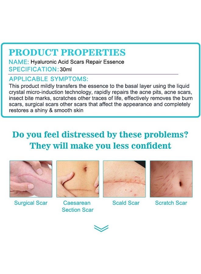 Hyaluronic Acid Scars Repair Essence Repair Cells Serum Moisturizing Essential Oil Skin Scar Removal Nourish Hydrate 30Ml/1.01Fl.Oz