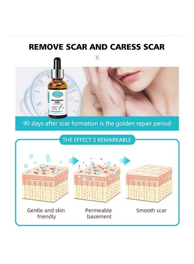 Hyaluronic Acid Scars Repair Essence Repair Cells Serum Moisturizing Essential Oil Skin Scar Removal Nourish Hydrate 30Ml/1.01Fl.Oz