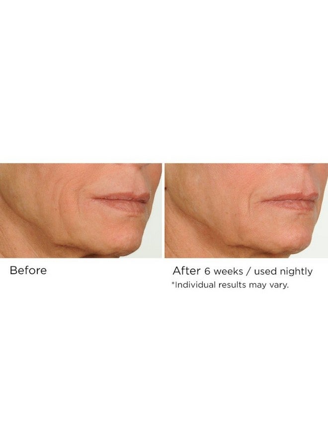 Nassifmd Night Therapy Serum