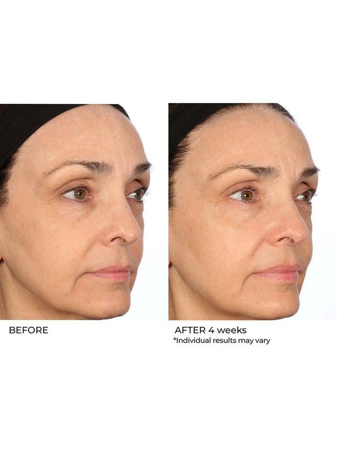 Nassifmd Pro Peptide Collagen Serum Peptide Serum Textured Skin Treatment Fine Lines And Wrinkles Treatment Anti Aging Serum Firms And Smooths Skin