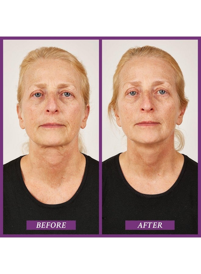 Beauty Ageless Throat Caviar Overnight Recovery Serum For Instantly Ageless Neck Neck Firming And Tightening Serum 1.7 Oz