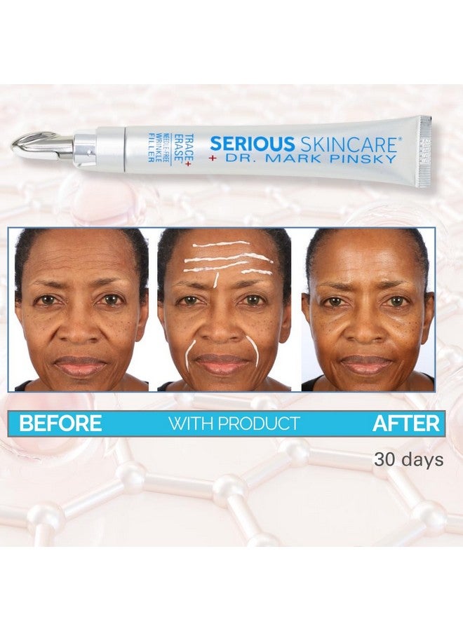 Dr. Mark Pinsky Trace + Erase Needle Free Wrinkle Filler 1 Oz Fills Visible Deep Lines Wrinkles And Creases Helps Restore Skin'S Youthful Elasticity And Tone Face And Neck