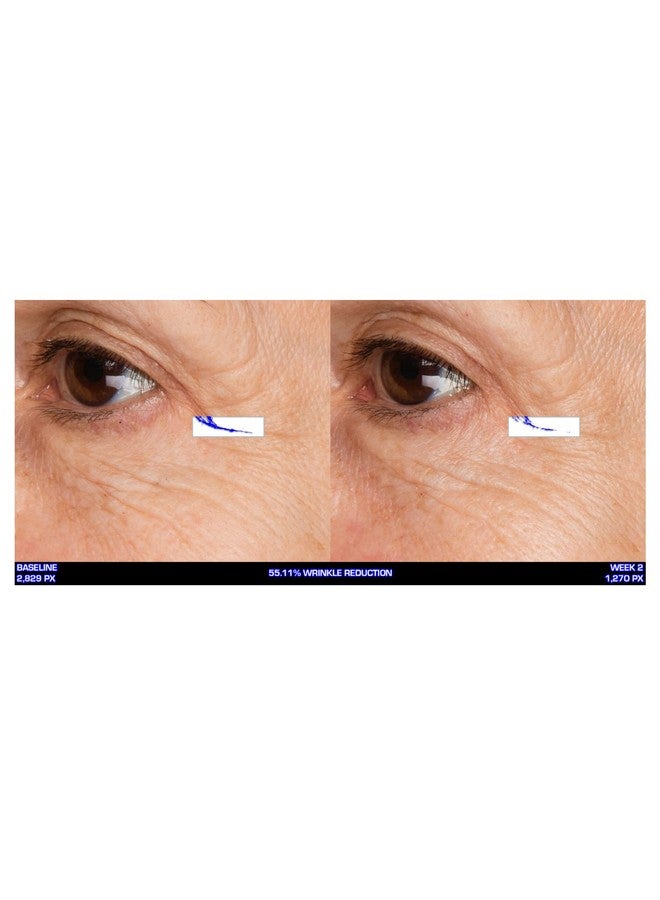 Ultramare Pure Marine Infusion Revitalizing Eye Cream Peptides Skin Renewing Encourages Collagen Production Helps Reduce Wrinkle Depth 0.5 Oz