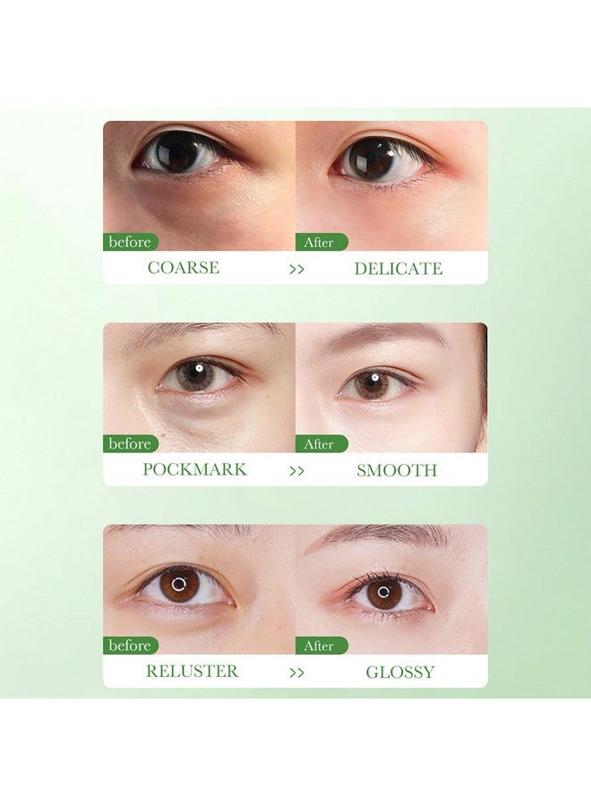 Centella Asiatica Nourish Repair Eye Cream Soothing Oil Control Antiacne 20G / 0.7Oz
