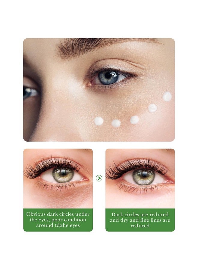 Centella Asiatica Nourish Repair Eye Cream Soothing Oil Control Antiacne 20G / 0.7Oz