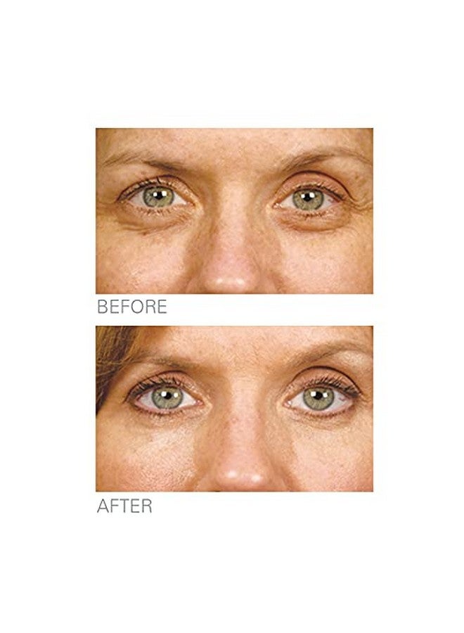 Stem Cell Therapy Eye Repair With Retinoid 160 Reduces The Appearance Of Fine Lines And Wrinkles By Supporting New Skin Growth And Encouraging Collagen Growth Via Timerelease Retinol
