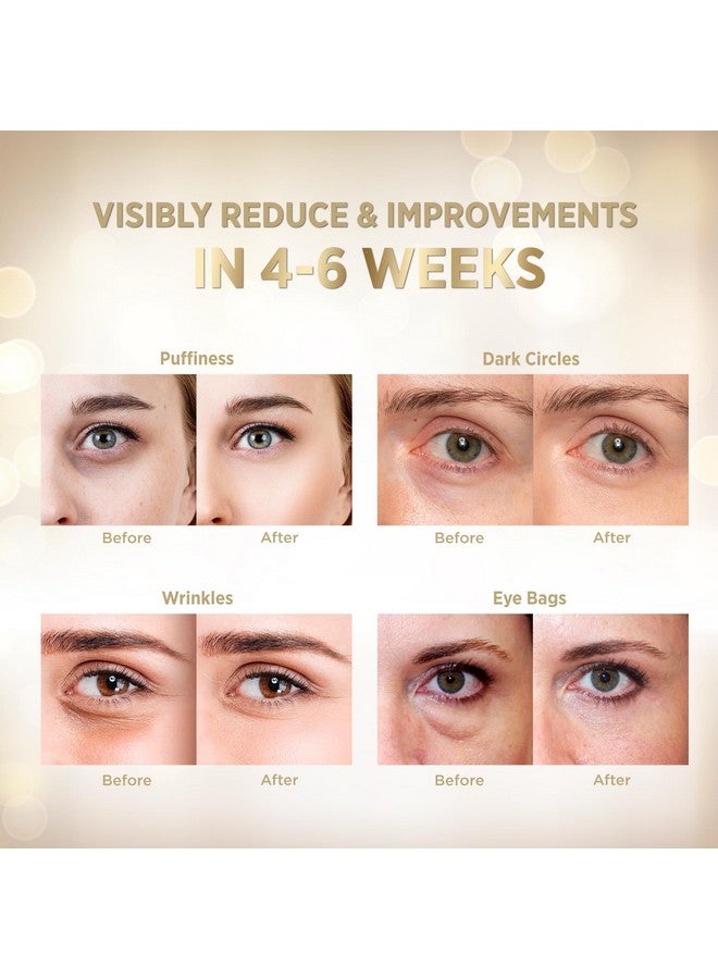 Under Eye Patches 24K Gold Under Eye Mask For Puffy Retinol Patchology Eye Patches For Wrinkles And Dark Circles Puffiness Collagen Under Eye Bags Treatment For Women Men 60 Pcs