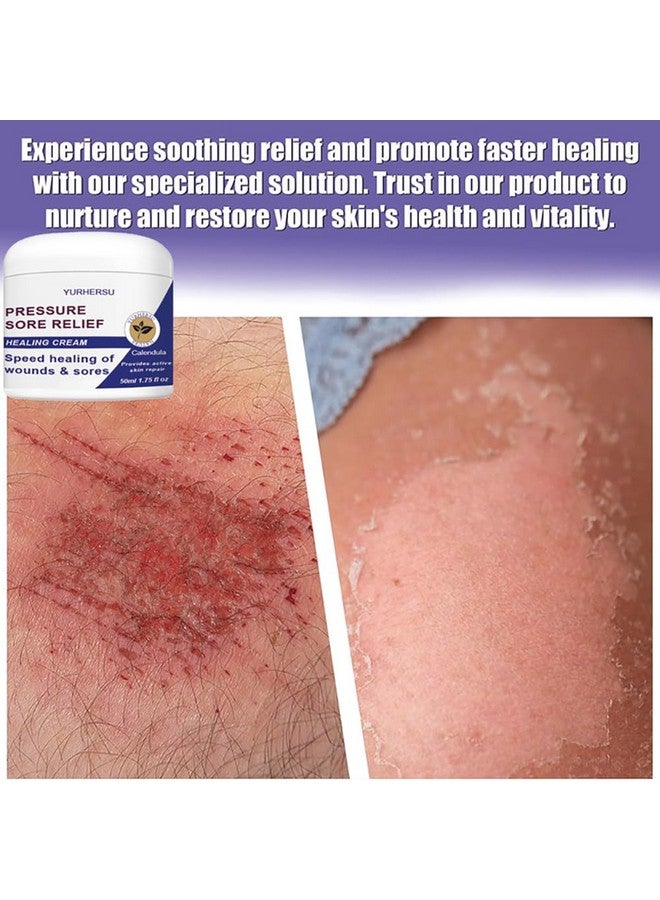 Pressure Sore Relief Healing Cream Speed Healing Wounds & Scores Relieving Redness Itchiness Keeping Skin Smooth Getting Healthier Skin Moisturizing Not Sticky Fast Absorption Or Skin