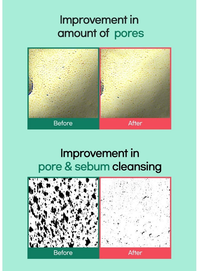 Tea Tree Cica Pore Clay Pack Double Set Vegan Deep Pore Cleansing Clay Mask For Pore Purifying Contains Cica & Tea Tree For Soothing & Relieving Stressed Skin