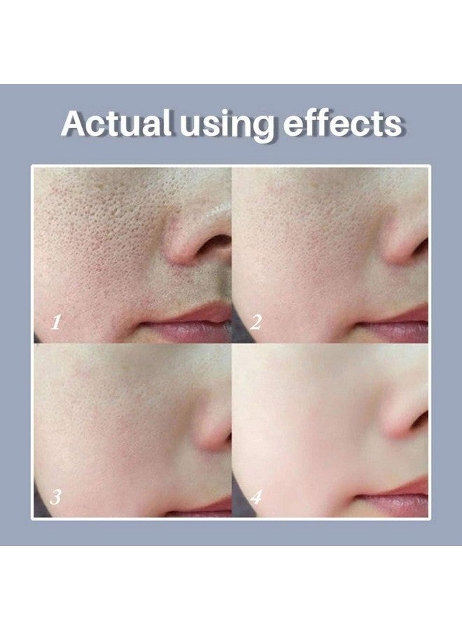 Pore Skin Care Serum Facial Essence Minimize Enlarged Pores For Tightening Pores Shrinking Pores + Relieving Dryness + Oil Control Firming + Moisturizing (New Packing)