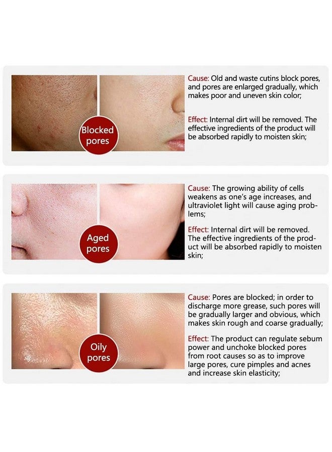 Pore Skin Care Serum Facial Essence Minimize Enlarged Pores For Tightening Pores Shrinking Pores + Relieving Dryness + Oil Control Firming + Moisturizing (New Packing)