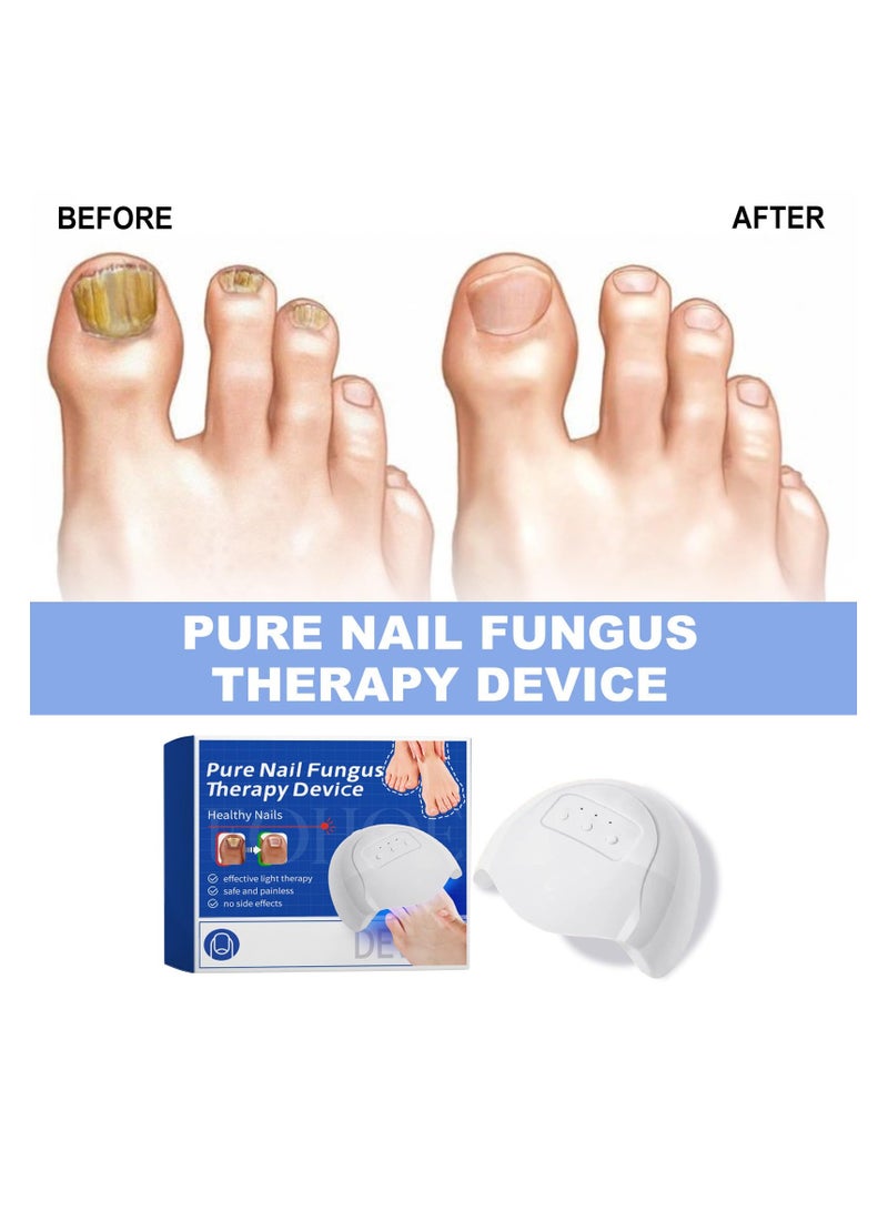 Fungal Nail Treatment Revitalizer, LED Light-Activated Therapy, Erase Toenail Discoloration Fungus, Nail Fungus Cleaning Lamp Device for Fingernails Toenail & Onychomycosis, Home Use.