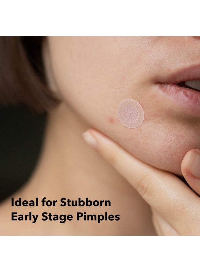 Multidart Spot Tech Microneedle Patch By Avarelle Acne Patches For Earlystage Blemish Stubborn Deep Rooted Pimples Facial Skin Acne Dots For Spots Cruelty Free Certified Carbonfree(18 Ct)