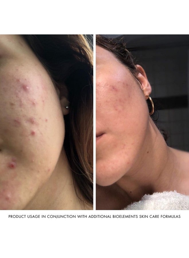 Skin Editor 1.7 Fl Oz Leaveon Aha Chemical Face Peel Cream For All Skin Types With 3% Glycolic Acid & 7% Lactic Acid Vegan Gluten Free Never Tested On Animals