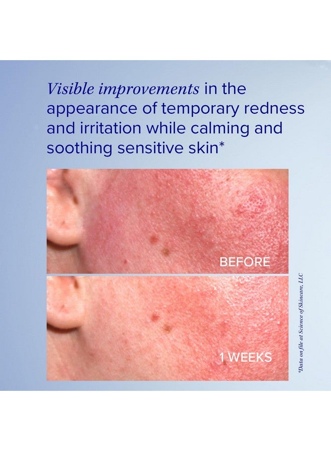Proheal Serum Advance+ Antioxidantrich Serum Containing Vitamin C E And A For Redness Rosacea Inflammation 0.5 Fl Oz