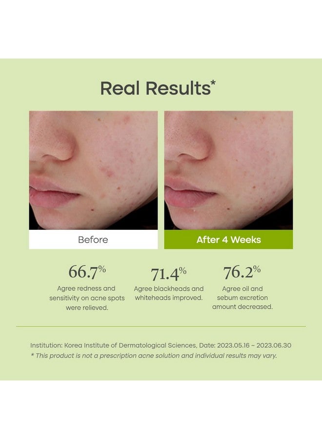 Clear Code Superfruit Serum 30Ml/1.01 Fl.Oz. Nextgeneration Clarifying Solution With Noni Fruit Extract Nonirritating Vegan Crueltyfree Suitable For Sensitive Skin Korean Skincare