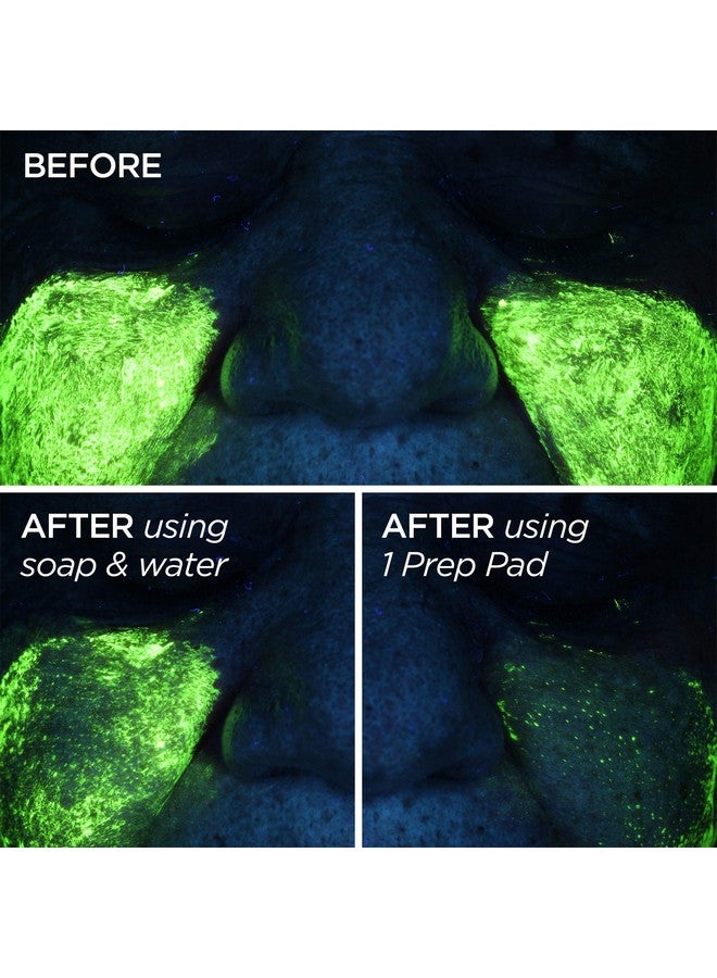 Prep Pads Clarifying Skin Cleansing Wipes And Steriglo Peptide 30 Count