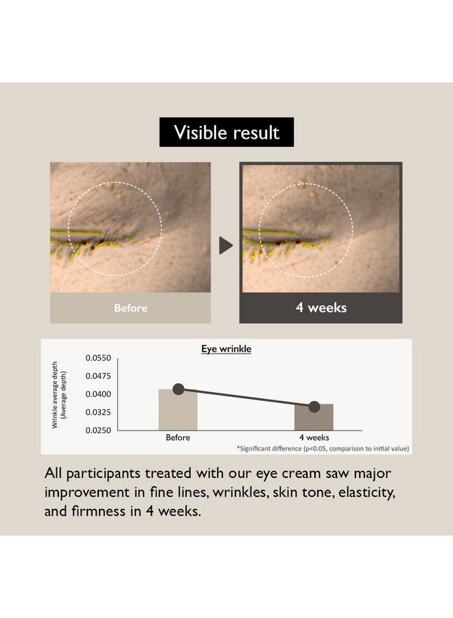 U Wonder] Black Rice Bakuchiol Eye Cream 0.67 Fl.Oz / 20Ml | Antiaging Wrinkle Care Natural Retinol Alternative | Cruelty Free Ewggreen