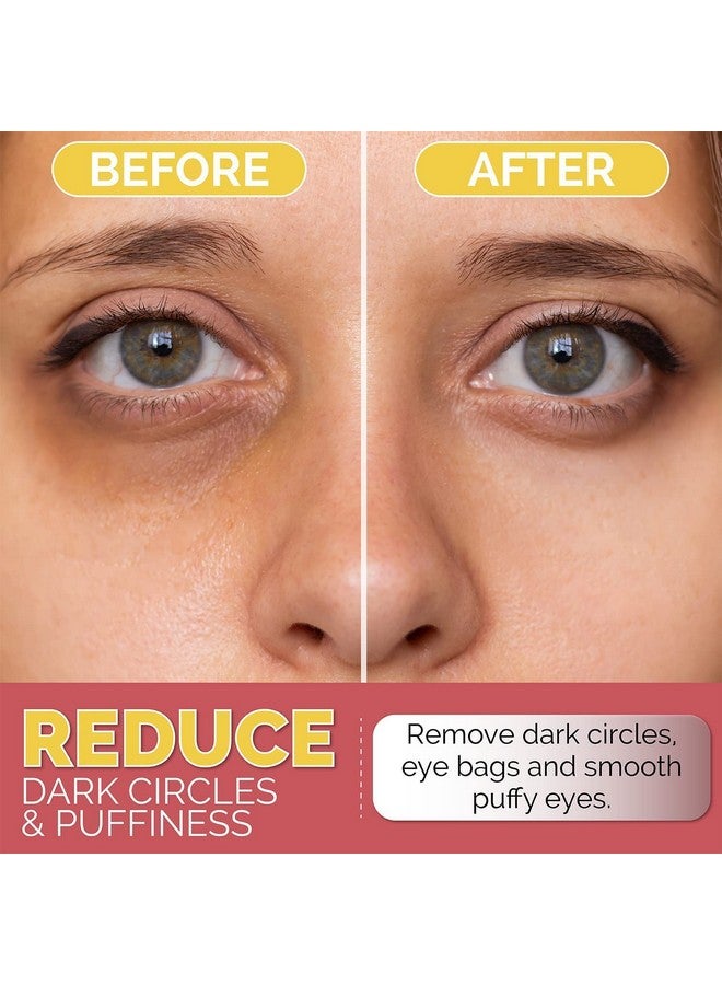 Under Eye Patches For Dark Circles, Puffiness And Eye Bags With 24K Gold Antiwrinkle For Puffy Eyes, Eye Masks With Hyaluronic Acid And Collagen Hydrogel Eye Gel Pads, Premium Korean Skincare 30Pcs