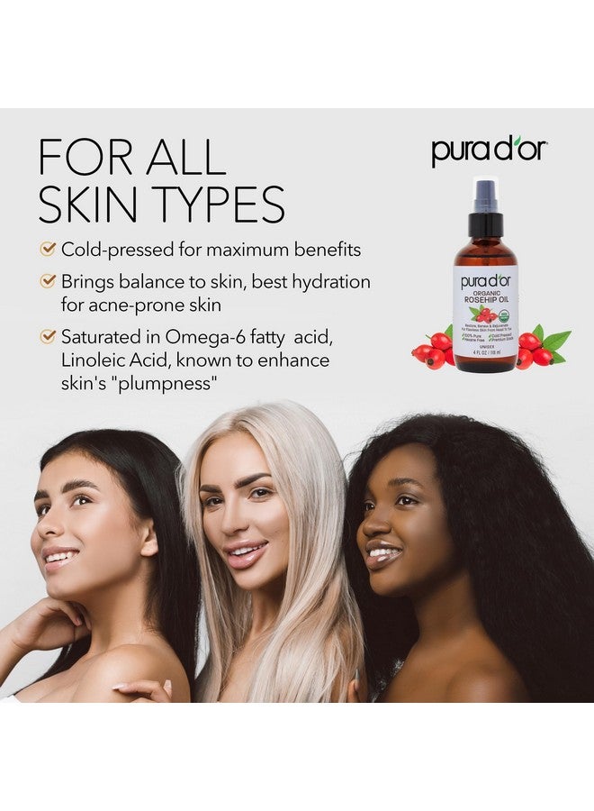 Organic Rosehip Seed Oil Hair Relaxer (4 Oz X3 = 12 Oz) 100% Pure Cold Pressed Usda Certified All Natural Antiaging Acne Scar Treatment Gua Sha Massage Face Hair & Skin Women & Men