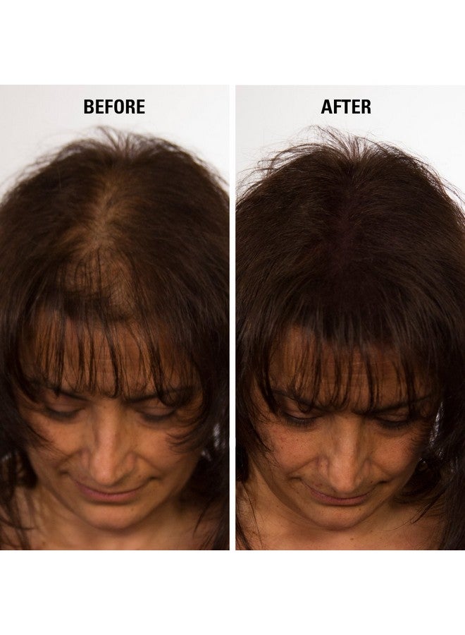 Eclipse Hair Fibers Dark Brown For Thinning Hair For Women & Men To Conceal Hair Loss In 15 Seconds 100% Undetectable Hair Building Fibers 15G