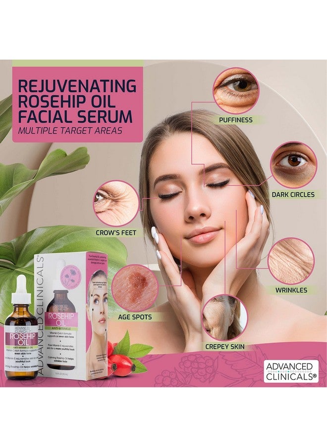 Rosehip Oil Facial Skin Care Serum Moisturizer Face Oil W/Vitamin C & Vitamin E For Reducing Appearance Of Sun Damage Skin, Age Spots, & Wrinkles, 1.8 Fl Oz (Pack Of 2)