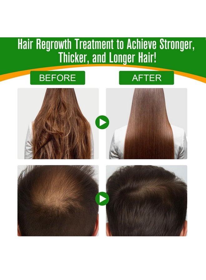 Batana Oil For Hair Growth 2.02 Fl Oz With Scalp Massage 100% Pure Batana Essential Oil For Skin Care Repairs Damaged Hair Nourishes The Scalp Reduces Hair Loss Hair Oil For All Hair Types