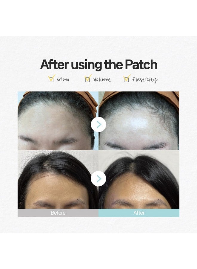 Forehead Wrinkle Patches 4Pcs 12Pcs For Tzone Overnight Face Lift & Chest Antiwrinkle Care With Collagen Hyaluronic Acid Vitamin E Labottach Korean Skincare (4)