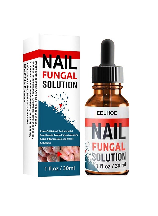 Nail Repair Solution Hand and Foot Nail Fungus Care Repairs Nail Fungus Fluid to Thicken Soft Nails Onychomycosis Care