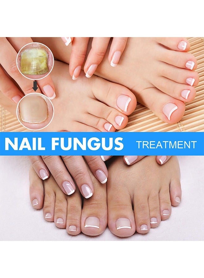 Nail Repair Solution Hand and Foot Nail Fungus Care Repairs Nail Fungus Fluid to Thicken Soft Nails Onychomycosis Care