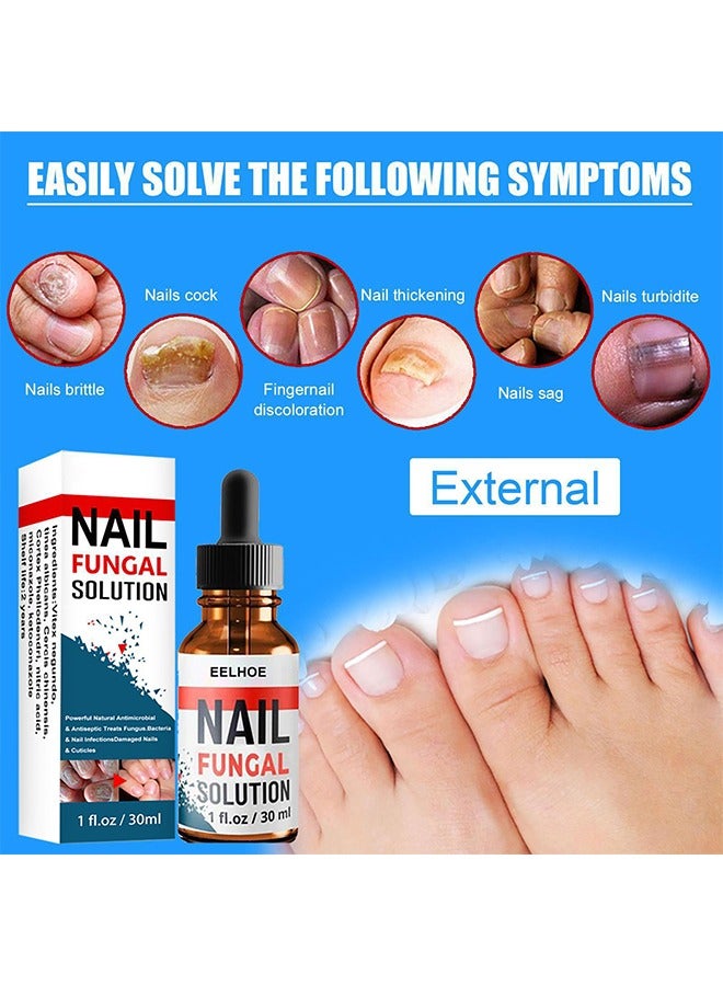 Nail Repair Solution Hand and Foot Nail Fungus Care Repairs Nail Fungus Fluid to Thicken Soft Nails Onychomycosis Care