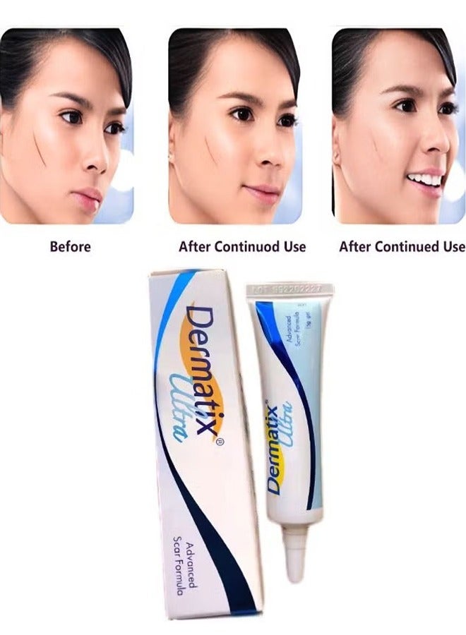 Advanced Scar Gel 15g For Cosmetic Improvement of Scars, Fast Drying and Unique Silicone Gel Formulation, Used For Treatment of Keloids, Surgical and Hypertrophic Scars, Suitable For Sensitive Skin