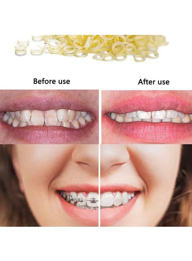 500 Pcs Orthodontic Elastic Rubber Bands, 3.5 Oz 1/4