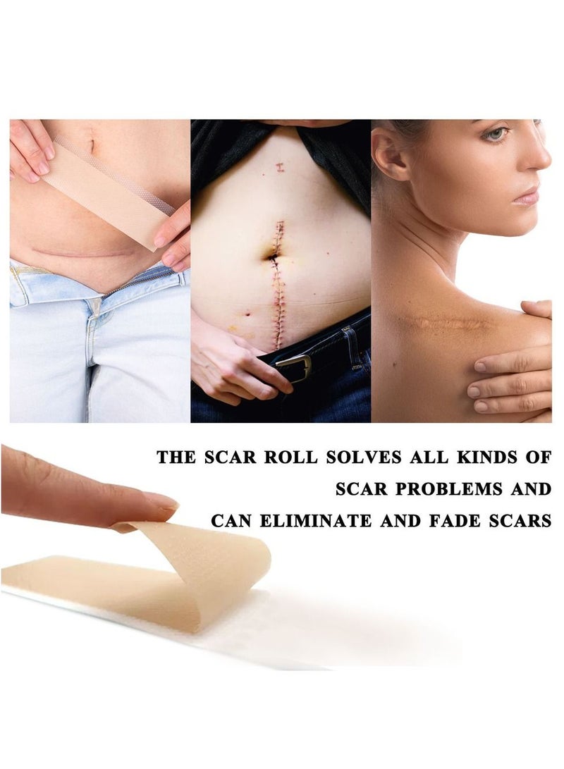 Medical Silicone Scar Sheets Roll 1.5m - Silicone Gel Sheets for Scar Removal, Silicone Sheets For Removing Scars Painlessly, Reusable Scar Gel Treatment,Cut Custom Size Strips