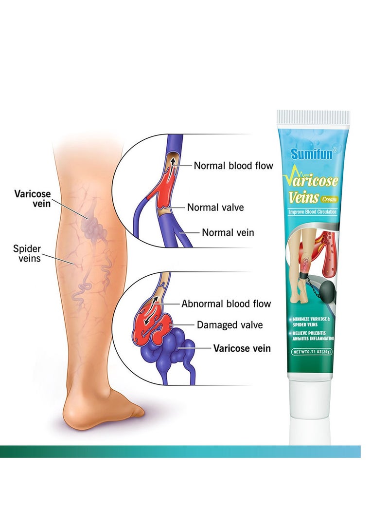 Varicose Veins Cream Relief Phlebitis Angiitis 100% Natural Ingredients Added Eliminate the Appearance of Varicose Veins - Vein Inflammation Treatment for Men & Women 20g