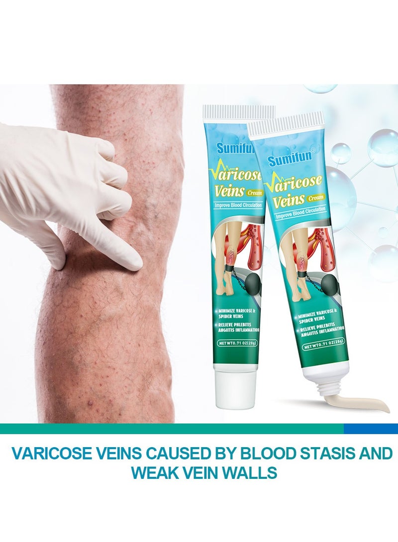 Varicose Veins Cream Relief Phlebitis Angiitis 100% Natural Ingredients Added Eliminate the Appearance of Varicose Veins - Vein Inflammation Treatment for Men & Women 20g