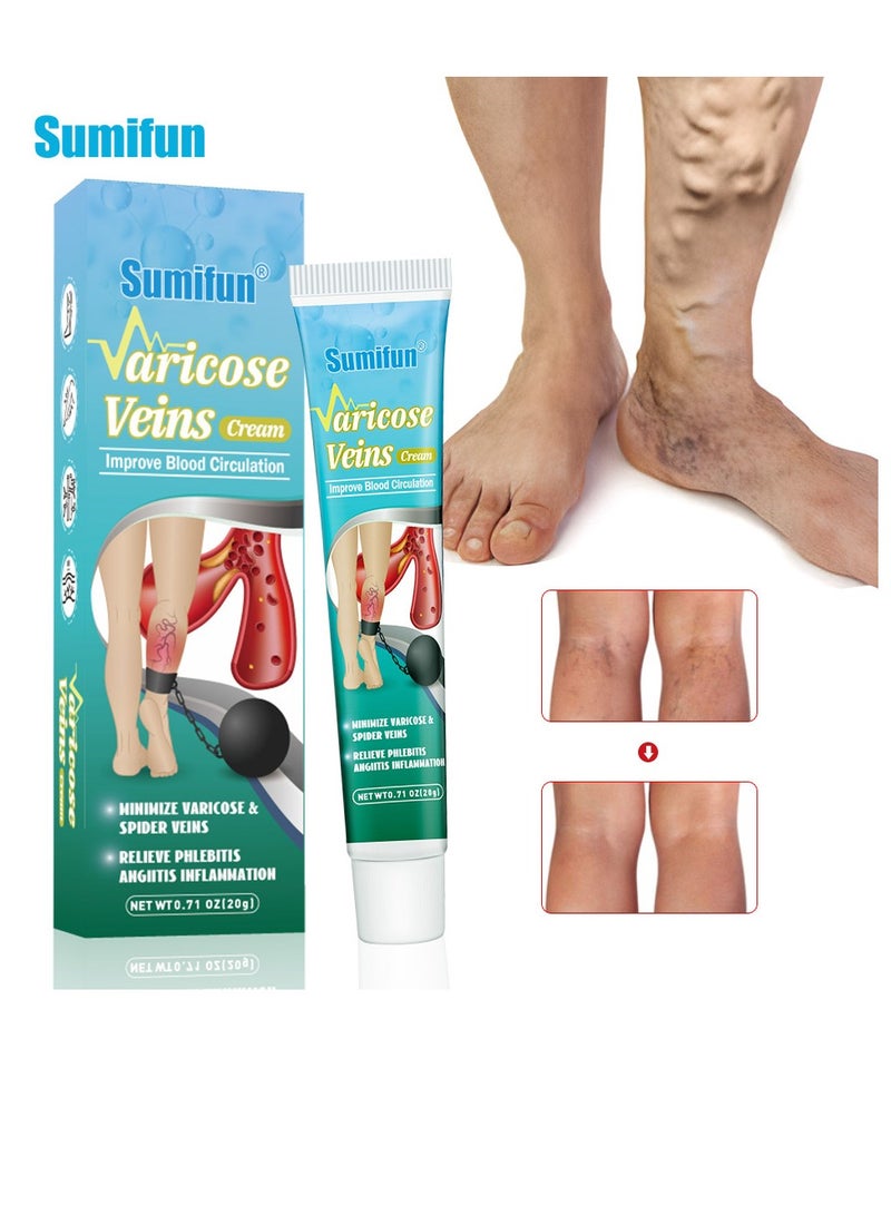 Varicose Veins Cream Relief Phlebitis Angiitis 100% Natural Ingredients Added Eliminate the Appearance of Varicose Veins - Vein Inflammation Treatment for Men & Women 20g