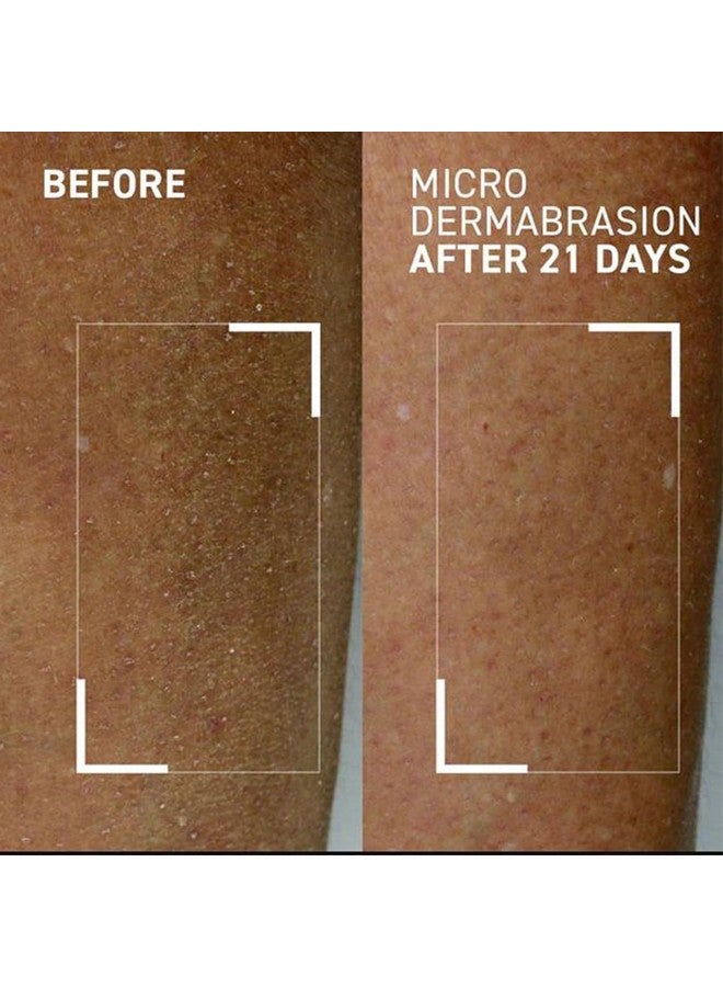 Dr. Brandt Microdermabrasion Body Polishing Exfoliator Targets Rough Dull And Dry Skin Improves Overall Appearance Of Body Skin 4.4 Oz