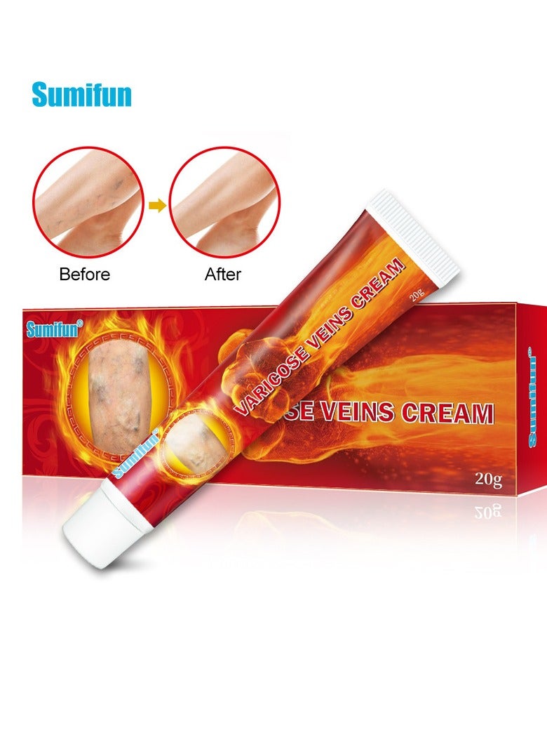 Varicose Vein Cream for Legs Reduces Spider Veins and Heaviness Anti Varicose Vein Soothing Leg Cream to Improve Blood Circulation Enhance Capillary Varicose Vein Repair Cream 20g