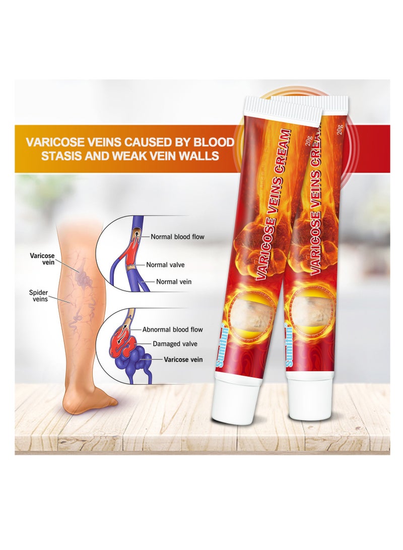 Varicose Vein Cream for Legs Reduces Spider Veins and Heaviness Anti Varicose Vein Soothing Leg Cream to Improve Blood Circulation Enhance Capillary Varicose Vein Repair Cream 20g