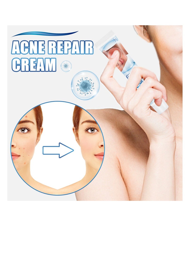 Acne Cream Herbal Anti-Acne Essence Acne Pimple Treatment Ointment Moisturizing Nourishing Repair Skin