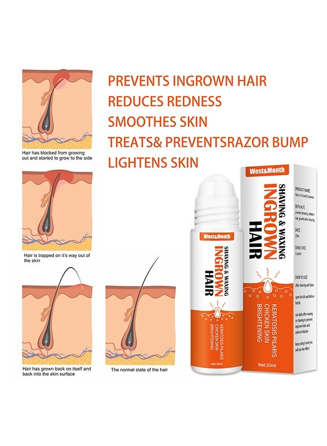 Ingrown Hair- Get Rid of Beard Nursing Essential Oils,Repairing Serum to Reduce Dark Spots After Shaving Gentle on Ingrown Hair 20ml