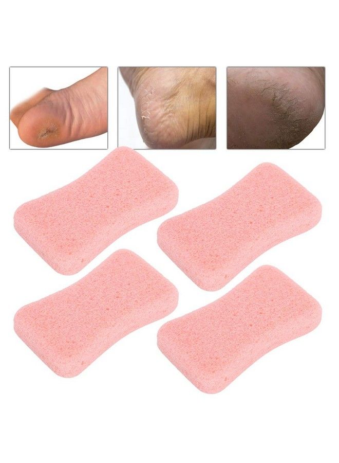 Pumice Stone For Feet 4Pcs Callus Remover And Foot Scrubber Pedicure Exfoliator Tool Hard Skin Callus Remover And Scrubber Portable Foot File Exfoliation To Remove Dead Skin (Pink)