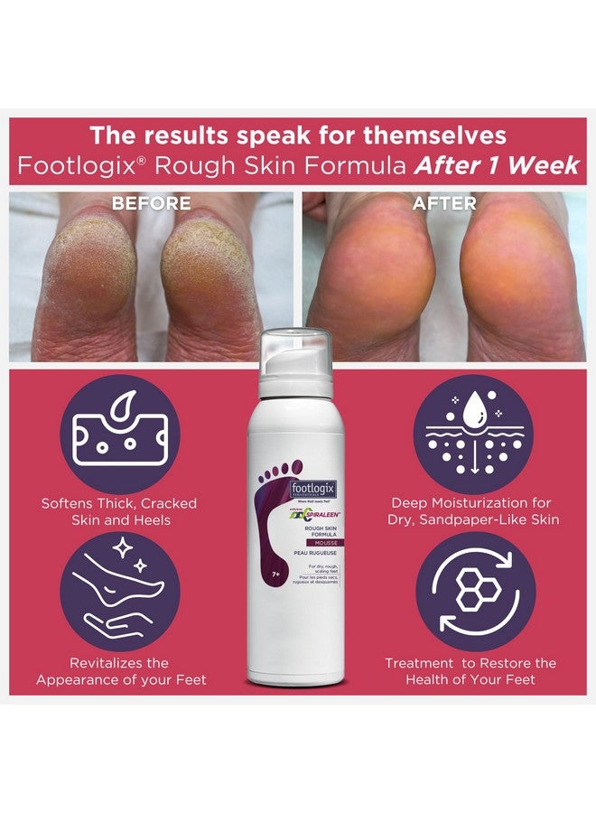 Rough Skin Formula Wspiraleen