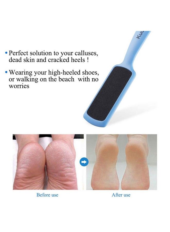 Foot File Callus Remover For Feet Doublesided Colossal Pedicure Tools Foot Rasp Foot Scrubber Dead Skin Exfoliator For Feet (Pack Of 4)